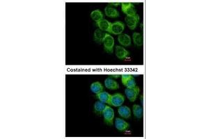 ICC/IF Image Immunofluorescence analysis of methanol-fixed A431, using PD-ECGF, antibody at 1:500 dilution. (Thymidine Phosphorylase 抗体)