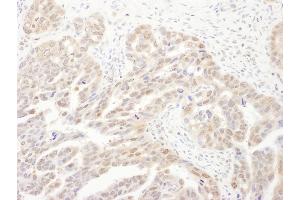 anti-Proteasome Subunit alpha 6 (PSMA6) (AA 196-246) antibody