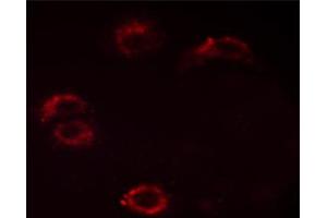 ABIN6267532 staining HUVEC cells by ICC/IF. (Crk 抗体  (pTyr221))