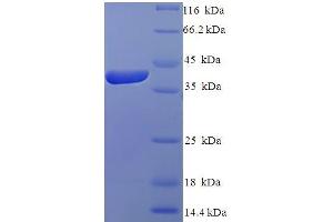 IZUMO4 Protein (AA 16-214, Isoform 2) (His-SUMO Tag)