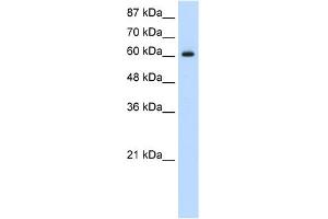 WB Suggested Anti-HIF3A Antibody Titration:  1. (HIF3A 抗体  (C-Term))