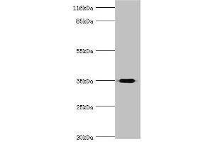 Western blot All lanes: DIMT1 antibody at 2 μg/mL + Mouse thymus tissue Secondary Goat polyclonal to rabbit IgG at 1/10000 dilution Predicted band size: 35 kDa Observed band size: 35 kDa (DIMT1 抗体  (AA 1-313))