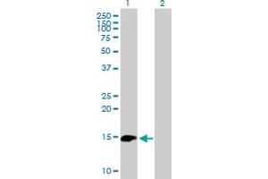 Western Blot analysis of BIRC5 expression in transfected 293T cell line by BIRC5 MaxPab polyclonal antibody. (Survivin 抗体  (AA 1-142))