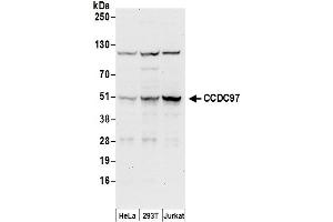anti-Coiled-Coil Domain Containing 97 (CCDC97) (AA 293-343) antibody
