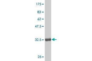 Western Blot detection against Immunogen (36. (CTNNB1 抗体  (AA 682-781))