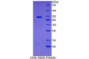 SDS-PAGE analysis of Human CIDEC Protein.