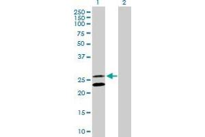 Lane 1: GADD45GIP1 transfected lysate ( 25. (GADD45GIP1 293T Cell Transient Overexpression Lysate(Denatured))