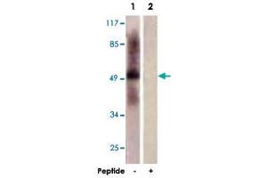 Western blot analysis of extracts from HepG2 cells, using TPH1 polyclonal antibody . (Tryptophan Hydroxylase 1 抗体  (AA 25-75))