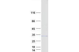 Western Blotting (WB) image for E3 Ubiquitin-Protein Ligase UNKL (UNKL) (Transcript Variant 1) protein (Myc-DYKDDDDK Tag) (ABIN2735022)