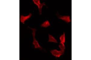 ABIN6275618 staining Hela by IF/ICC. (SYT16 抗体  (Internal Region))