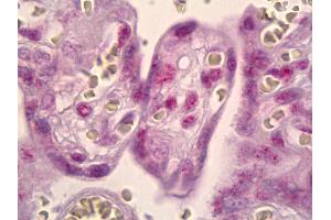 Anti-MSK1 antibody IHC of human placenta. (MSK1 抗体)