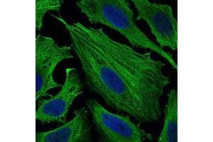 Immunofluorescent staining of Hela cells with SMCP monoclonal antibody, clone 5C10D8  at 1:200-1:1000 dilution.