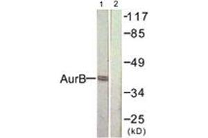Western blot analysis of extracts from COS7 cells, treated with Nocodazole 1ug/ml 16h, using AurB (Ab-232) Antibody. (Aurora Kinase B 抗体  (AA 198-247))