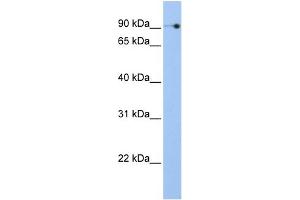WB Suggested Anti-NOC3L Antibody Titration:  0. (NOC3L 抗体  (N-Term))