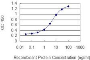 Detection limit for recombinant GST tagged BCL11A is 0. (BCL11A 抗体  (AA 1-88))