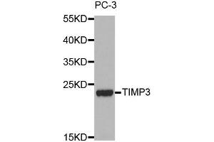 Western blot analysis of extracts of PC-3 cell lines, using TIMP3 antibody. (TIMP3 抗体  (AA 24-211))