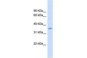 Image no. 1 for anti-Family with Sequence Similarity 26, Member F (FAM26F) (AA 143-192) antibody (ABIN6742019) (FAM26F 抗体  (AA 143-192))