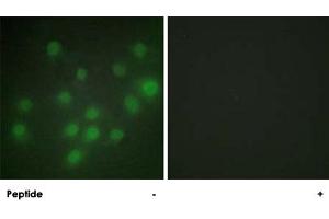 Immunofluorescence analysis of HUVEC cells, using HKR1 polyclonal antibody . (HKR1 抗体)