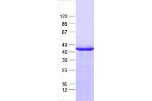 Western Blotting (WB) image for Paired-Like Homeodomain 2 (PITX2) protein (His tag) (ABIN2729027)