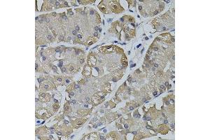 Immunohistochemistry of paraffin-embedded human stomach using TRPC3 antibody. (TRPC3 抗体)
