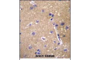Immunohistochemistry (Paraffin-embedded Sections) (IHC (p)) image for anti-ATP-Binding Cassette, Sub-Family C (CFTR/MRP), Member 12 (ABCC12) (AA 723-752) antibody (ABIN657120)