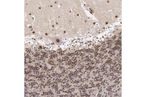 Immunohistochemical staining of human cerebellum with NCOR2 polyclonal antibody  shows strong moderate nuclear positivity in Purkinje cells, cells in molecular layer and cells in granular layer. (NCOR2 抗体)
