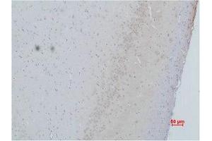 Immunohistochemistry (IHC) image for anti-Calcium Channel, Voltage-Dependent, gamma Subunit 2 (CACNG2) antibody (ABIN3181547)