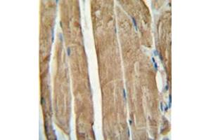 Immunohistochemistry analysis in formalin fixed and paraffin embedded human skeletal muscle reacted with PGAM2 Antibody (N-term) followed which was peroxidase conjugated to the secondary antibody and followed by DAB staining. (PGAM2 抗体  (N-Term))