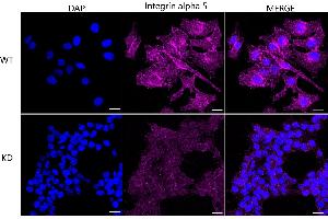 Immunocytochemical staining of HeLa cells using Integrin alpha 5 antibody (ABIN7799077), 1:1,000), Top panel: wild-type (WT), Bottom panal: Integrin alpha 5 shRNA knockdown (KD). (Recombinant ITGA5 抗体)