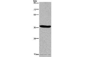 Western blot analysis of LO2 cell, using KCNK17 Polyclonal Antibody at dilution of 1:300 (KCNK17 抗体)