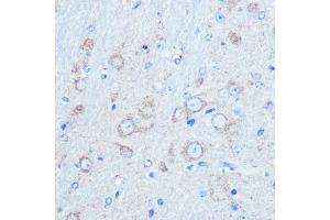 Immunohistochemistry of paraffin-embedded mouse brain using LC3B Rabbit pAb (ABIN6129924 and ABIN6143474) at dilution of 1:100 (40x lens).
