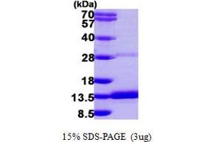SDS-PAGE (SDS) image for Dynein, Light Chain, Roadblock Type 2 (DYNLRB2) (AA 1-96) protein (His tag) (ABIN667383) (DYNLRB2 Protein (AA 1-96) (His tag))