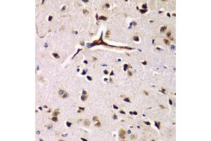 Immunohistochemistry of paraffin-embedded rat brain using EIF2AK4 antibody (ABIN5974303) at dilution of 1/100 (40x lens). (GCN2 抗体)