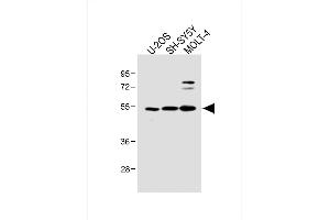 Western Blotting (WB) image for anti-STE20-Related Kinase Adaptor alpha (STRADA) (AA 12-41), (N-Term) antibody (ABIN391217)