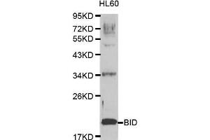 Western blot analysis of extracts of HL60 cell lines, using BID antibody. (BID 抗体  (AA 1-130))