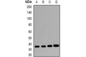 Western blot analysis of VSIG2 expression in LDL (A), PC3 (B), mouse stomach (C), rat stomach (D) whole cell lysates. (VSIG2 抗体)
