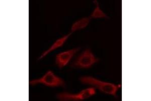 ABIN6275041 staining HuvEc cells by IF/ICC. (HSD11B1 抗体  (N-Term))
