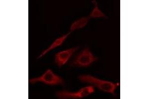 ABIN6275041 staining HuvEc cells by IF/ICC.