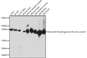 Western blot analysis of extracts of various cell lines, using Pyruvate Dehydrogenase E1 beta subunit Rabbit mAb (ABIN7269772) at 1:1000 dilution. (PDHB 抗体)