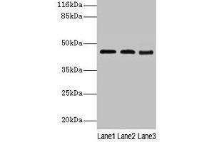 Western blot All lanes: BCAT2 antibody at 2 μg/mL Lane 1: NIH/3T3 whole cell lysate Lane 2: Mouse kidney tissue Lane 3: Mouse spleen tissue Secondary Goat polyclonal to rabbit IgG at 1/10000 dilution Predicted band size: 45, 34 kDa Observed band size: 45 kDa (BCAT2 抗体  (AA 28-392))