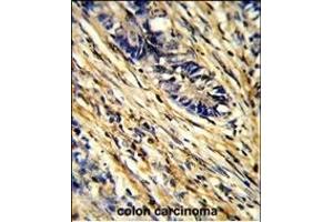 Immunohistochemistry (Paraffin-embedded Sections) (IHC (p)) image for anti-14-3-3 gamma (YWHAG1) (AA 136-164) antibody (ABIN389486)