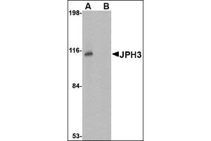 Western blot analysis of JPH3 in Daudi cell lysate with this product at 1 μg/ml in (A) the absence and (B) the presence of blocking peptide. (Junctophilin 3 抗体  (Center))