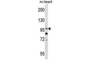 SULF2 Antibody (C-term) western blot analysis in mouse heart tissue lysates (35µg/lane). (SULF2 抗体  (C-Term))