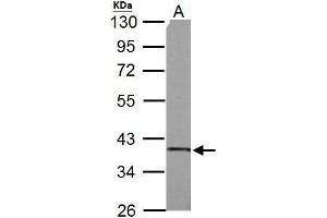 Western Blotting (WB) image for anti-Succinate-CoA Ligase, alpha Subunit (SUCLG1) antibody (ABIN2856658)