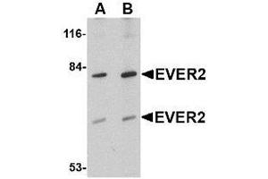 Western blot analysis of EVER2 in Jurkat cell lysate with AP30323PU-N EVER2 antibody at (A) 1 and (B) 2 μg/ml. (TMC8 抗体  (Center))