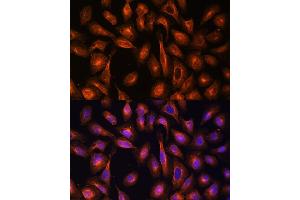 Immunofluorescence (IF) image for anti-Spectrin alpha Chain, Brain (SPTAN1) (AA 950-1130) antibody (ABIN6148403)