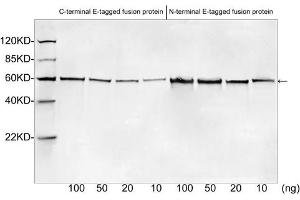 Western blot analysis of E tagged fusion proteins expressed in E. (E Tag 抗体)