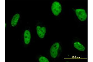 Immunofluorescence of monoclonal antibody to MPG on HeLa cell. (MPG 抗体  (AA 1-90))