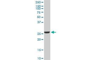 GSTA2 monoclonal antibody (M05), clone 3D4. (GSTa2 抗体  (AA 1-100))