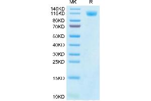 SDS-PAGE (SDS) image for SARS-CoV-2 Spike S1 (P.1 - gamma) protein (His tag) (ABIN7274778)